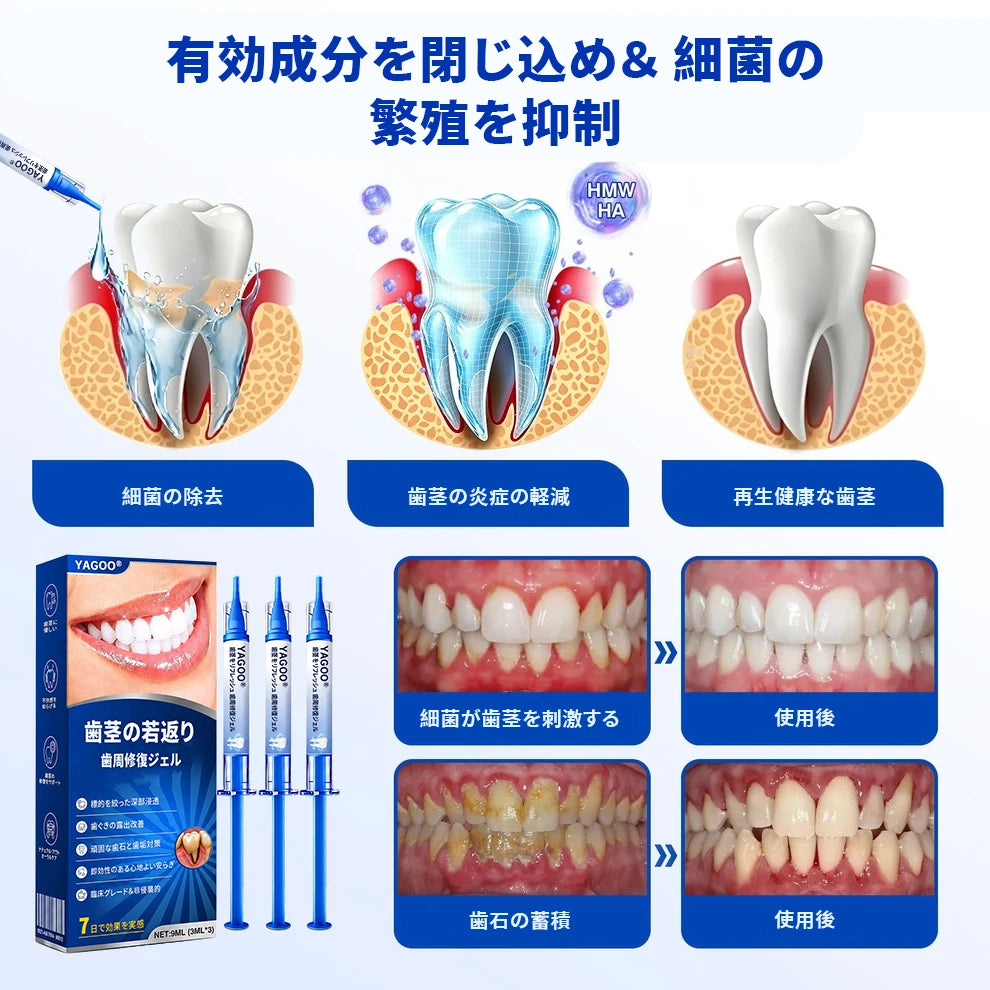 【話題の口内ケア】薬用薬用級デンタルプロジェル|お口のネバつき・気になる口臭を防ぐ高粘性オーラルジェル(30g)