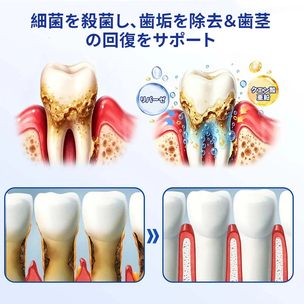 【話題の口内ケア】薬用薬用級デンタルプロジェル｜お口のネバつき・気になる口臭を防ぐ高粘性オーラルジェル（30g）