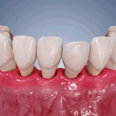 YAGOO® Advanced Gum Therapy Gel for Receding Gums & Loose Teeth