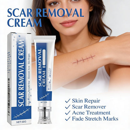 🔥𝑶𝒇𝒇𝒊𝒄𝒊𝒂𝒍 𝑺𝒕𝒐𝒓𝒆 | TIWORLD® Scar Removal Cream — Restore Skin & Regain Confidence🌹
