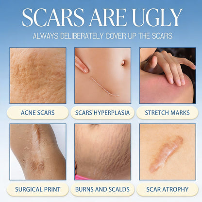 🔥𝑶𝒇𝒇𝒊𝒄𝒊𝒂𝒍 𝑺𝒕𝒐𝒓𝒆 | TIWORLD® Scar Removal Cream — Restore Skin & Regain Confidence🌹