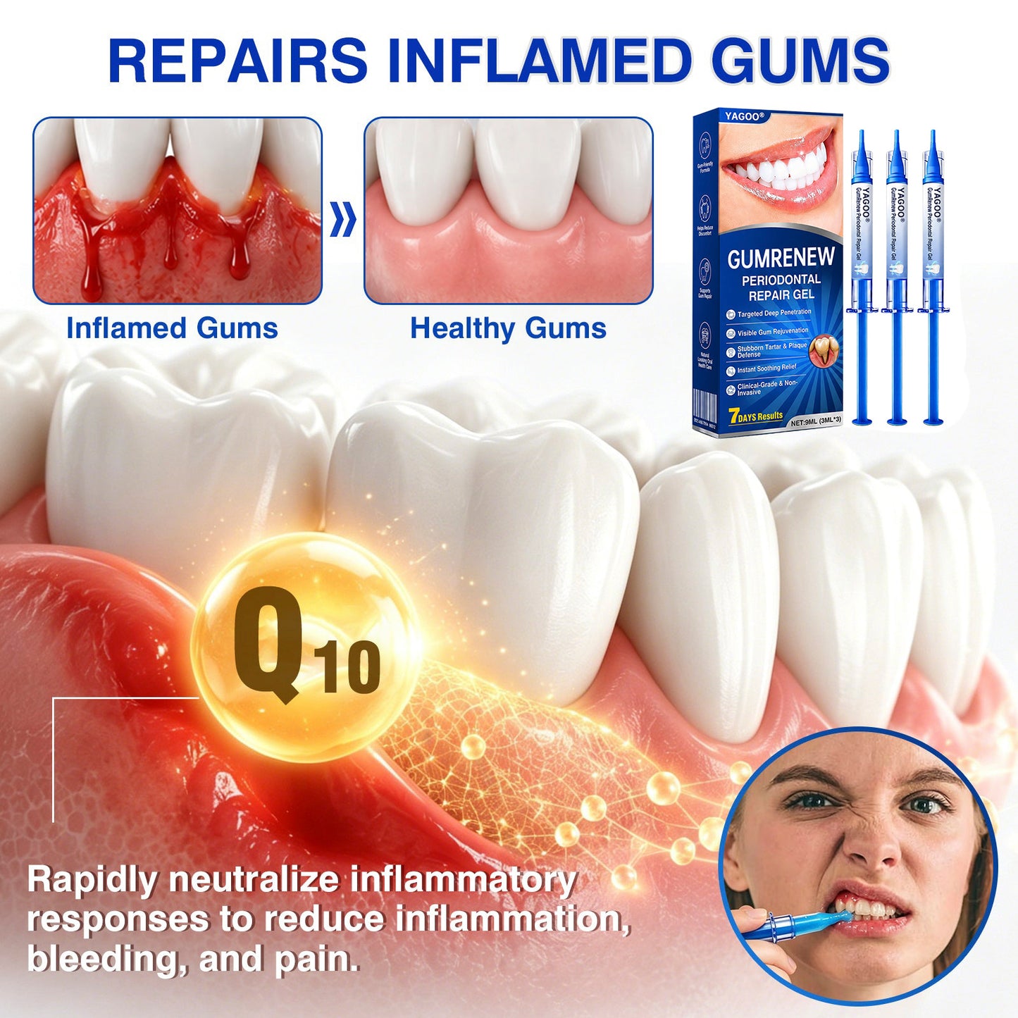 YAGOO® Advanced Gum Therapy Gel for Receding Gums & Loose Teeth