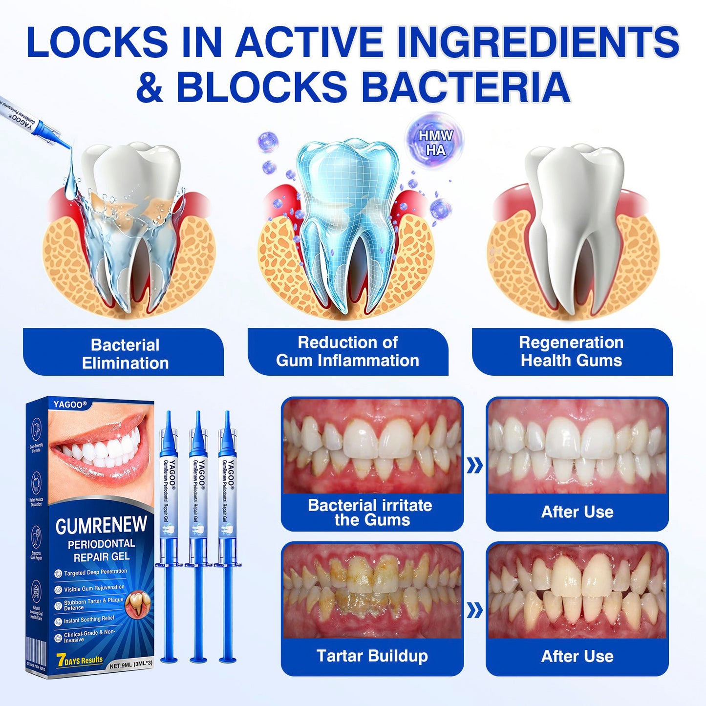 YAGOO® Advanced Gum Therapy Gel for Receding Gums & Loose Teeth
