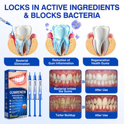 YAGOO® Advanced Gum Therapy Gel for Receding Gums & Loose Teeth